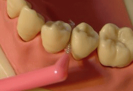 歯間ブラシの使い方