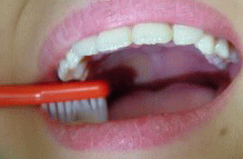 口の横から歯ブラシを入れる様子
