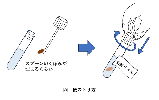 便のとり方